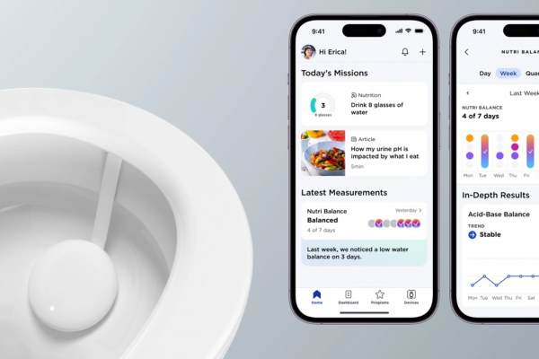 The Withings UScan urine analyzing toilet attachment